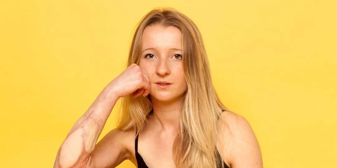 This powerful photographer will change how you see scars This powerful photographer will change how you see scars