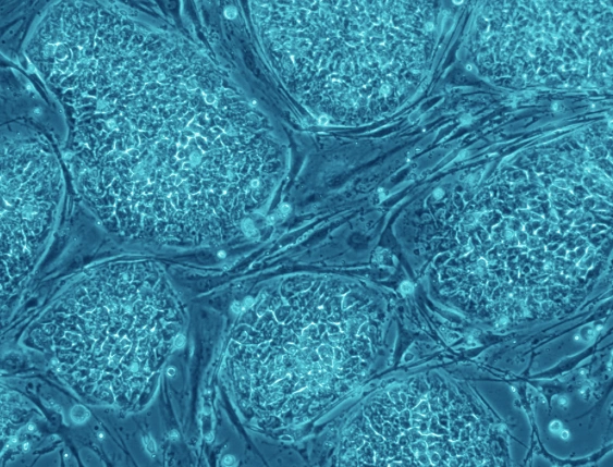 Gene editing and the ethics behind correcting biological imperfections