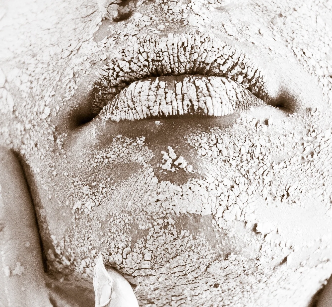 How to deal with eczema flare-ups in winter