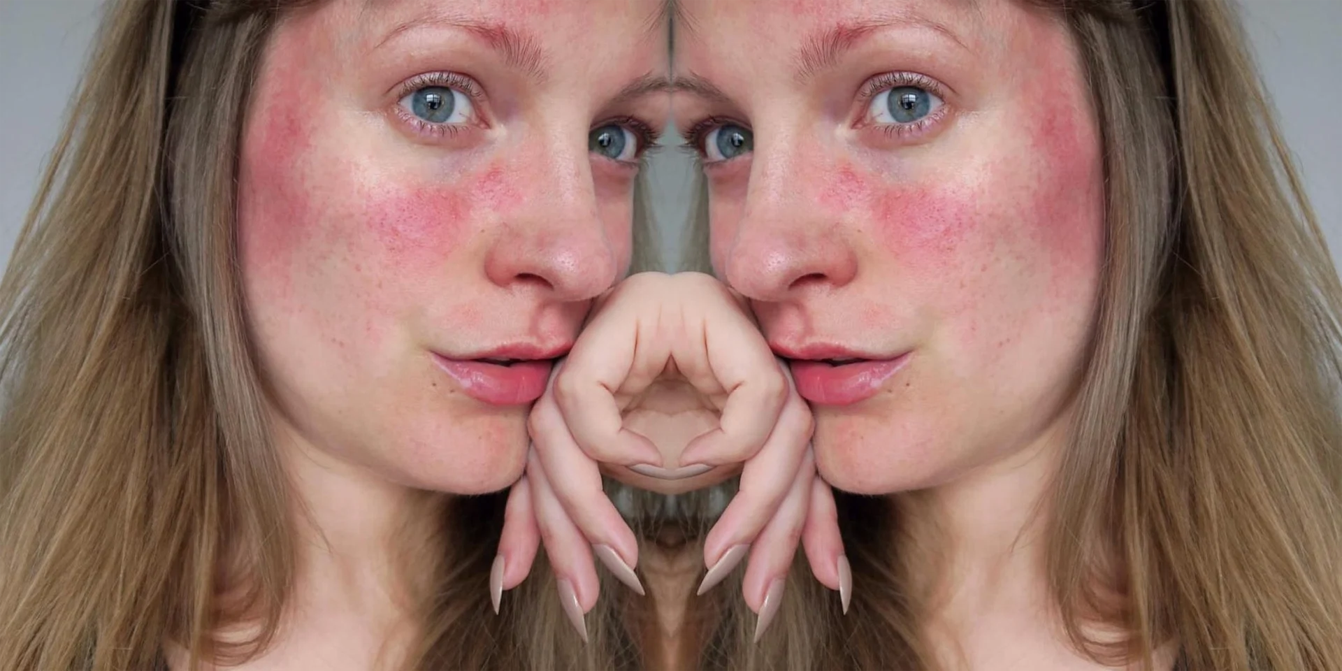 A dermatologist’s guide to rosacea A dermatologist’s guide to rosacea