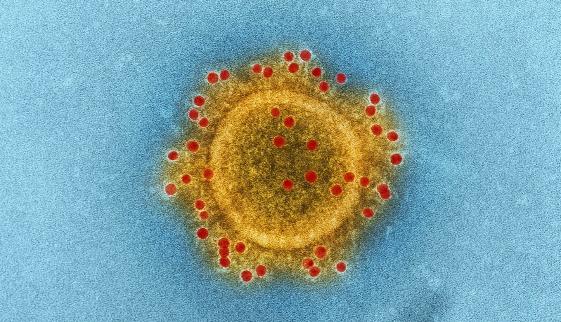 Cases rise, more Irish travel restrictions to EU, US adds Ireland to ban