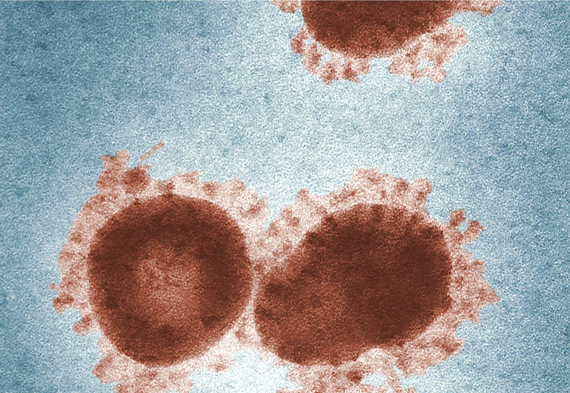 Health Chief details changes in testing criteria for Covid-19