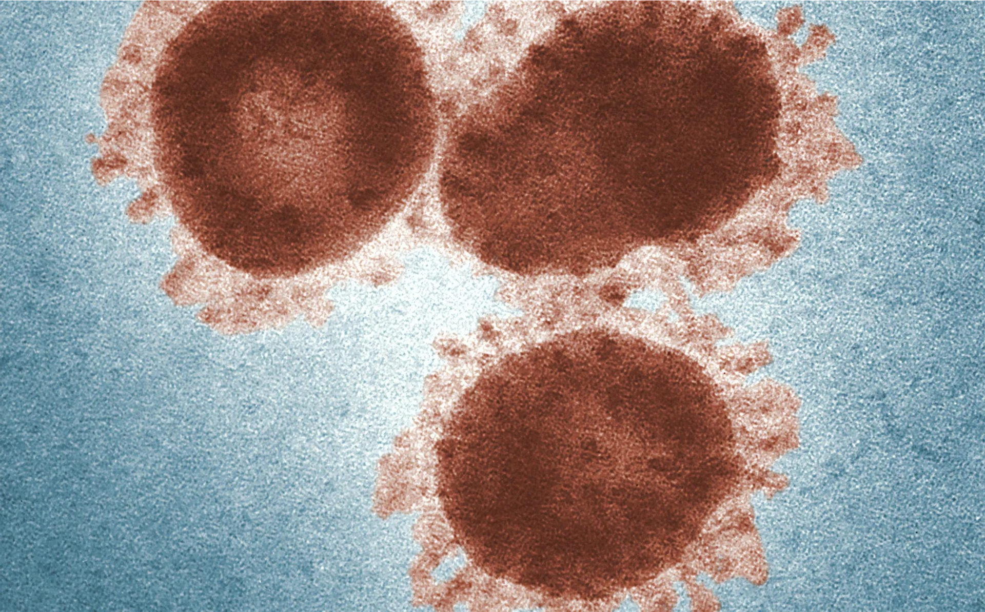 Coronavirus update: 55% have fully recovered from Covid-19