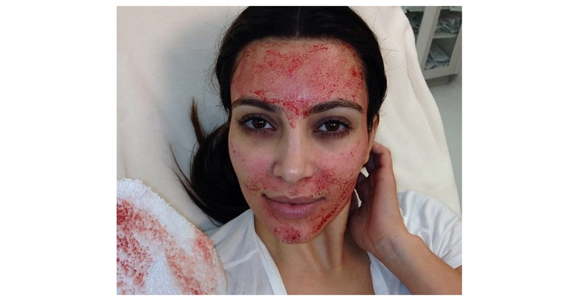 I tried the infamous Vampire Facial