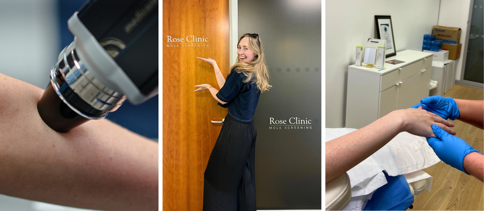 I tried a mole mapping service – here’s everything you need to know