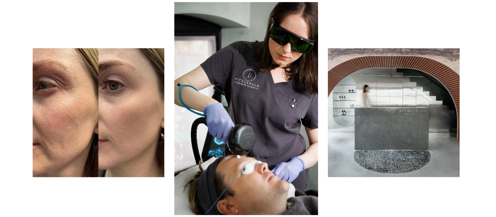 Timeless radiance: the enduring appeal of IPL